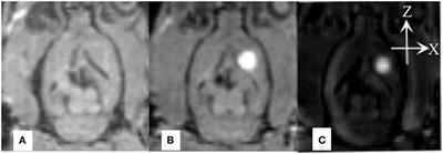 Stimulation Modeling on Three-Dimensional Anisotropic Diffusion of MRI Tracer in the Brain Interstitial Space